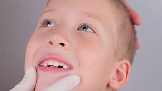 Kinderzähne
